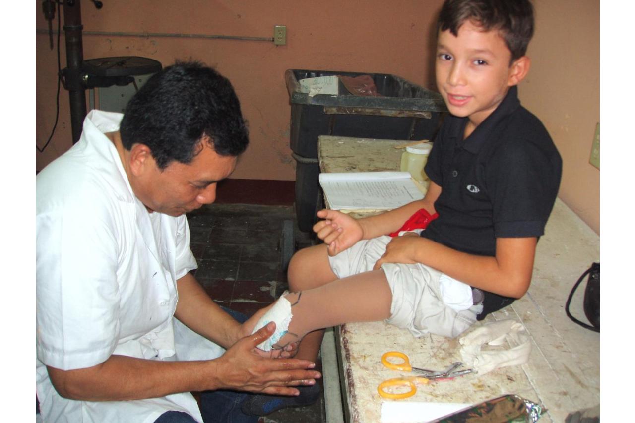 Prosthetist fits a young boy with a prosthetic leg.