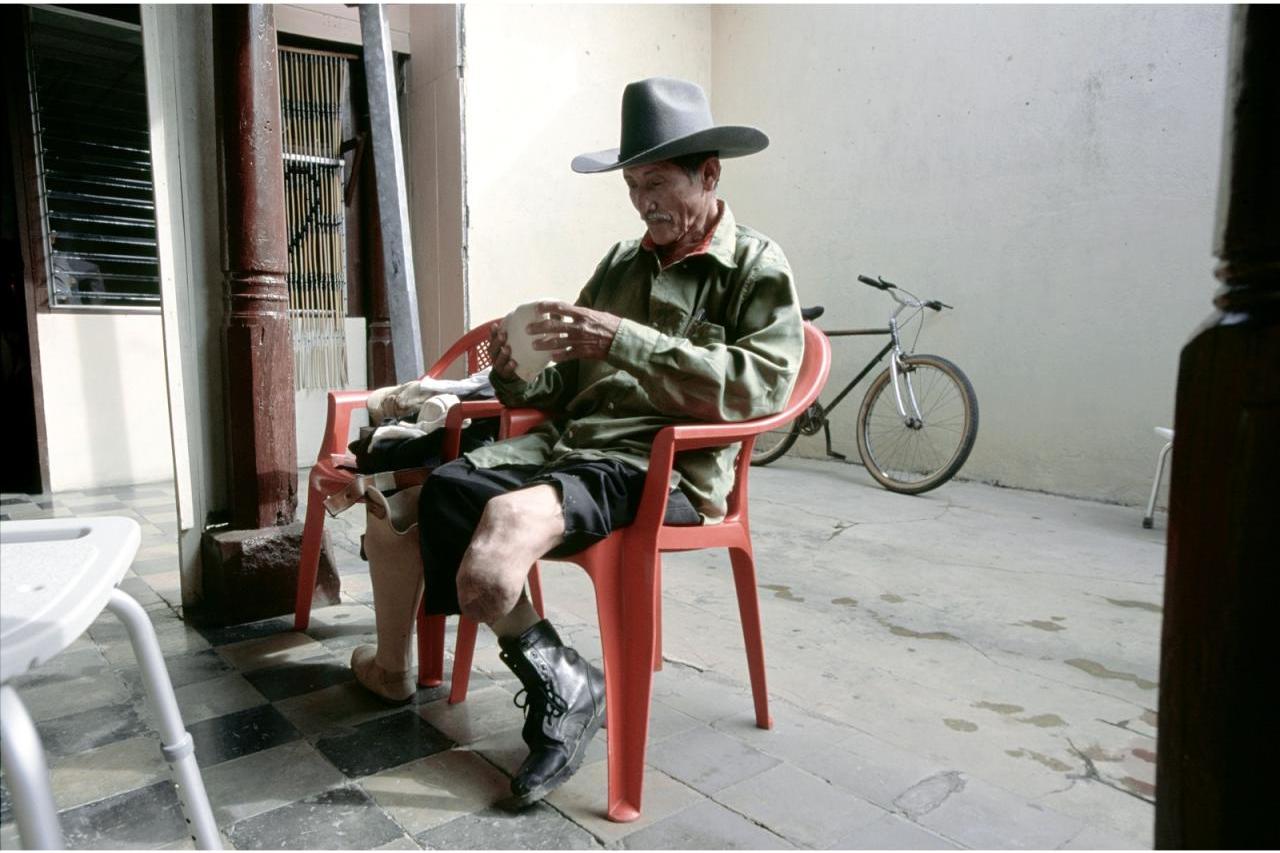 Man with prosthetic leg sitting in a plastic chair (photo by Stephen Petegorsky)