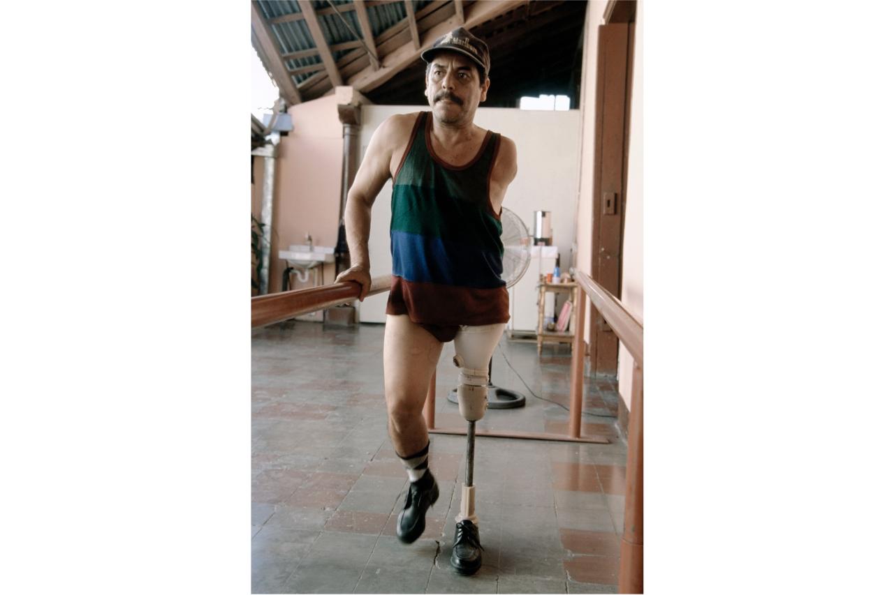 Man walking and trying out a new prosthetic leg at prosthetic clinic in Nicaragua (photo by Stephen Petegorsky)