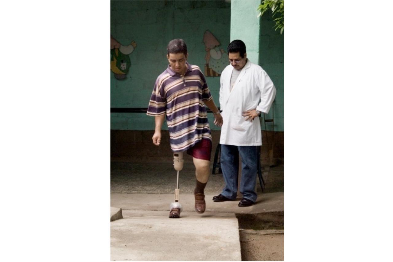 man with prosthetic leg walking while technician observes how the new limb works (photo by Stephen Petegorsky)